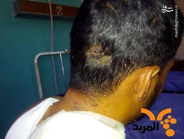 روایت رزمنده عراقی از نجات معجزه آسا از دست داعش+عکس روایت رزمنده عراقی از نجات معجزه آسا از دست داعش+عکس