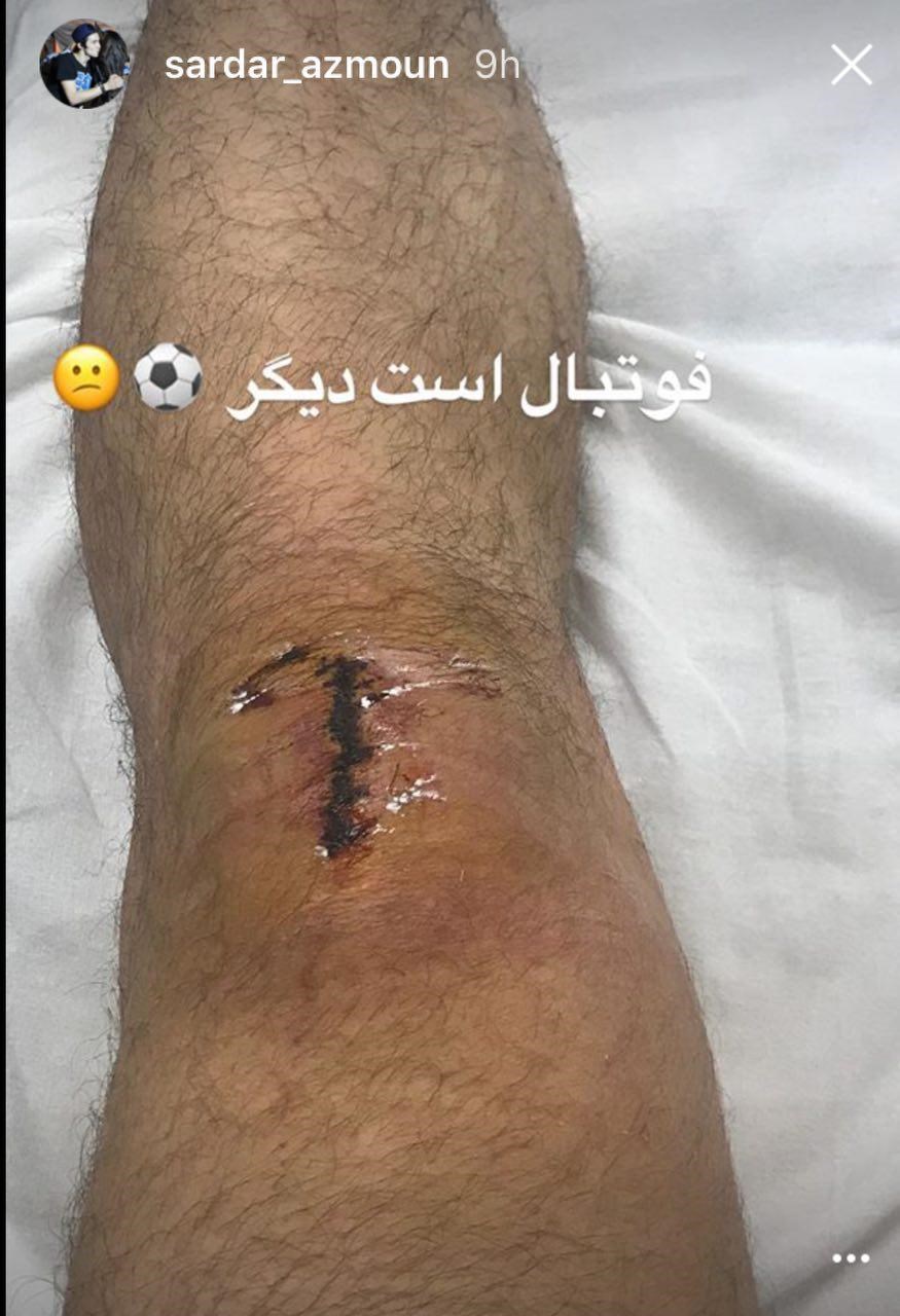 جراحت سردار آزمون، دستاورد دیدار با سوریه! +عکس