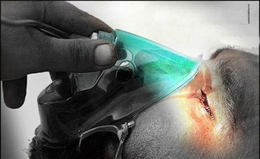 اجرای پروتکل ویژه برای خدمت به جانبازان شیمیایی اجرای پروتکل ویژه برای خدمت به جانبازان شیمیایی