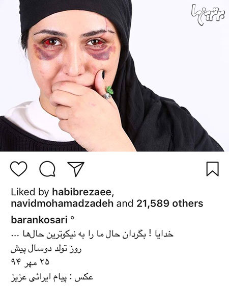 تصویر خاص و عجیب بازیگر زن بعد از تصادف + عکس