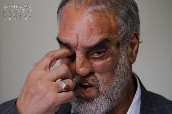 یک صورت ، یک ترکش، 58 تیغ / از دهانم تکه استخوان خرد شده ...! یک صورت ، یک ترکش، 58 تیغ / از دهانم تکه استخوان خرد شده ...!