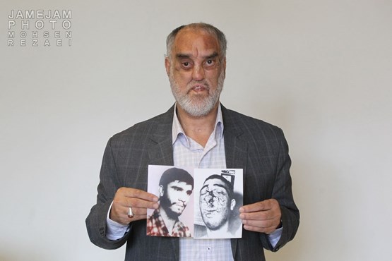 یک صورت ، یک ترکش، 58 تیغ / از دهانم تکه استخوان خرد شده ...! یک صورت ، یک ترکش، 58 تیغ / از دهانم تکه استخوان خرد شده ...!