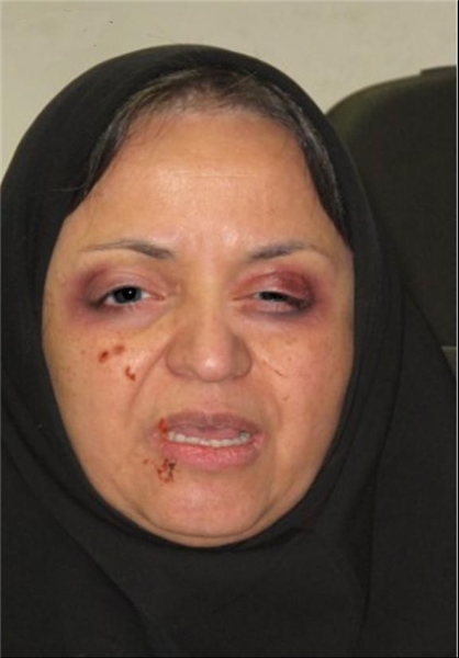 فتوشاپ تصویر استاد دانشگاه با هدف تشنج در دانشگاه فتوشاپ تصویر استاد دانشگاه با هدف تشنج در دانشگاه