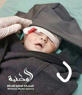شهادت نوزاد فلسطینی در حمله صهیونیستها + عکس شهادت نوزاد فلسطینی در حمله صهیونیستها + عکس