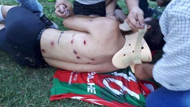 پلیس آرژانتین بازیکنان فوتبال را به گلوله بست + عکس پلیس آرژانتین بازیکنان فوتبال را به گلوله بست + عکس
