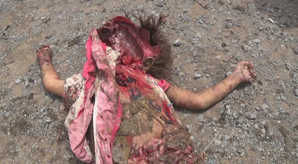شهادت 14 یمنی در جنایت هولناک جنگندههای سعودی شهادت 14 یمنی در جنایت هولناک جنگندههای سعودی