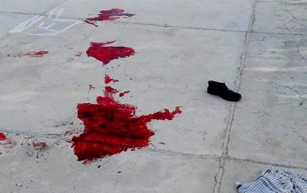 شهادت یکی از مجروحان حادثه تروریستی نیکشهر شهادت یکی از مجروحان حادثه تروریستی نیکشهر