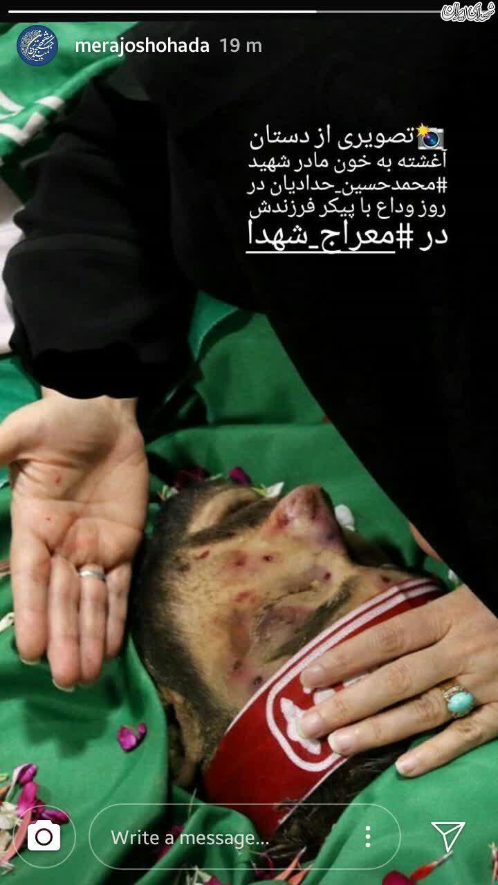 عکس/ دستان آغشته به خون مادر شهید