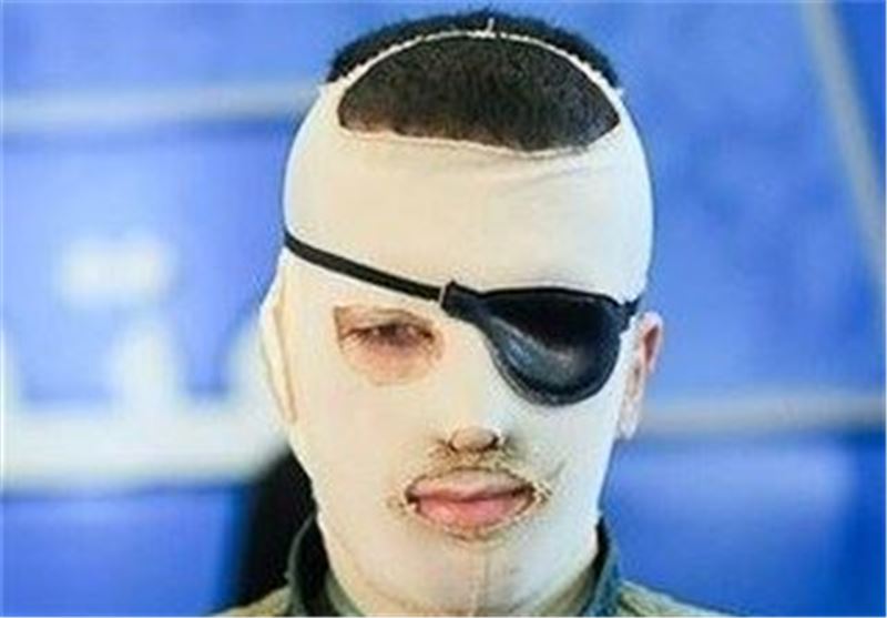 افساد فی الارض و اعدام برای مرتکبان اسید پاشی
