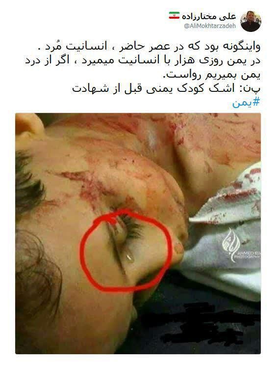 اینگونه بود که انسانیت مرد!/ اشک کودک قبل از شهادت
