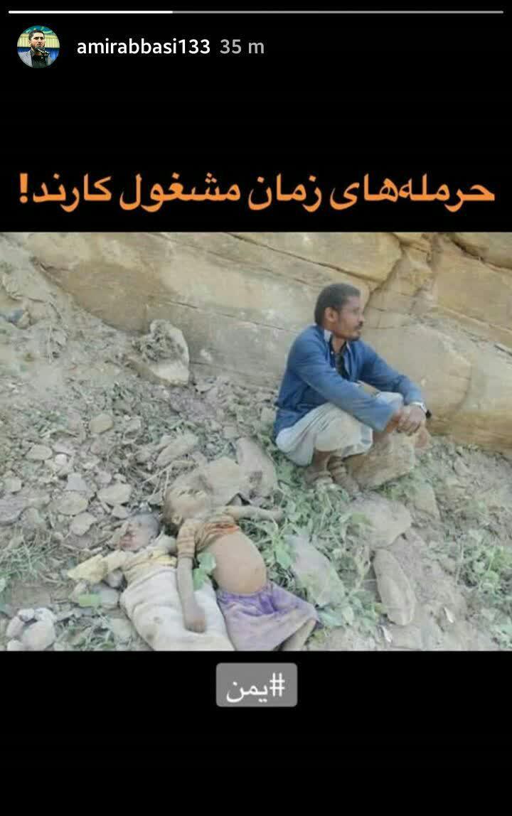 استوری امیر عباسی پیرامون وضع مردم مظلوم یمن