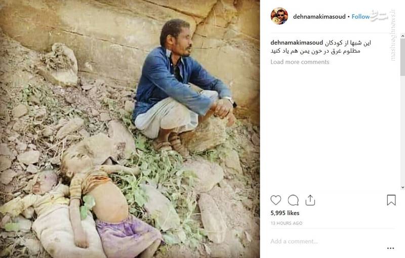 تصویری تکان دهنده در اینستاگرام مسعود ده نمکی