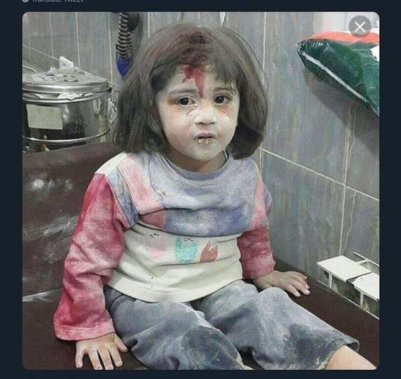 اگر چشمان این دختربچه آبی بود...!