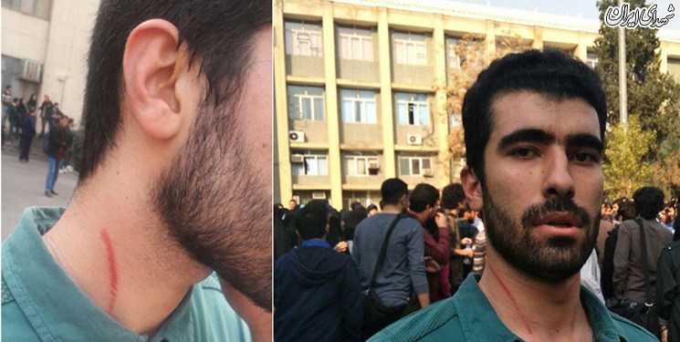 جوان مجروح از زیر و بم نقشه آمدنیوز چه گفت؟ جوان مجروح از زیر و بم نقشه آمدنیوز چه گفت؟