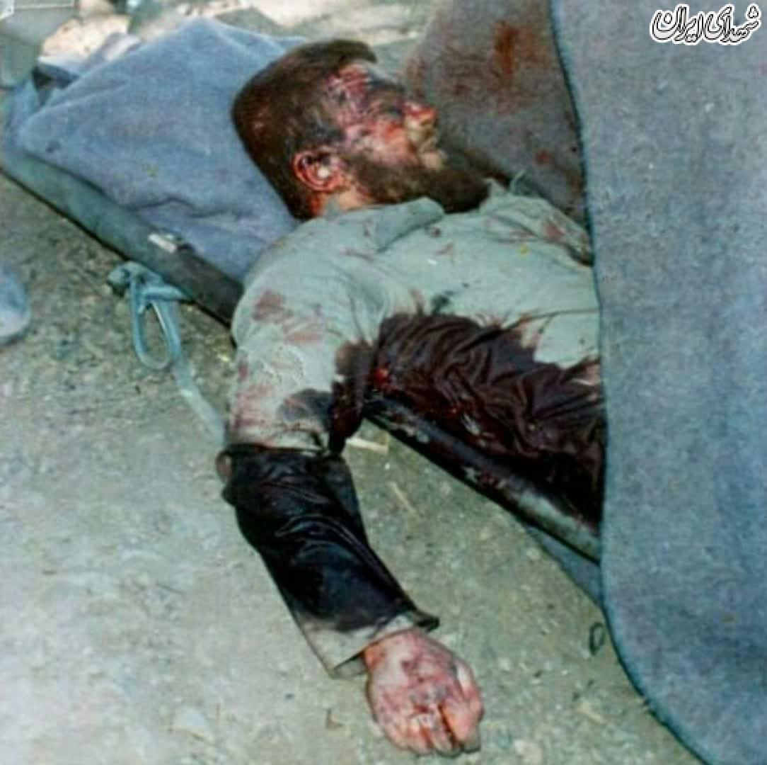 اسارت ۱۱عراقی به دست یک نوجوان مجروح! +عکس اسارت ۱۱عراقی به دست یک نوجوان مجروح! +عکس