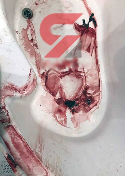 محل قتل 
