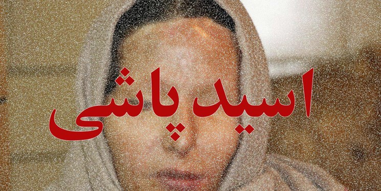 طرح تشدید مجازات اسیدپاشی در شورای نگهبان تایید شد طرح تشدید مجازات اسیدپاشی در شورای نگهبان تایید شد