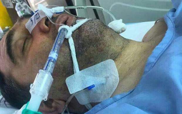 وضعیت نگرانکننده مداح جانبازی که در کماست وضعیت نگرانکننده مداح جانبازی که در کماست