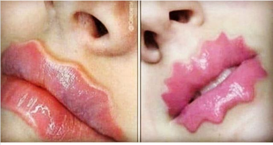 پس از گوش الاغی، لب ستاره ای هم مد شد پس از گوش الاغی، لب ستاره ای هم مد شد
