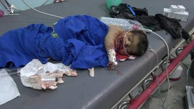 کشته و زخمی شدن ۳۶ کودک یمنی از زمان حذف نام ائتلاف عربی از لیست سیاه کشته و زخمی شدن ۳۶ کودک یمنی از زمان حذف نام ائتلاف عربی از لیست سیاه