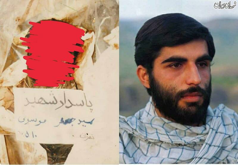 معلمی که پوستش کنده شد! + عکس معلمی که پوستش کنده شد! + عکس