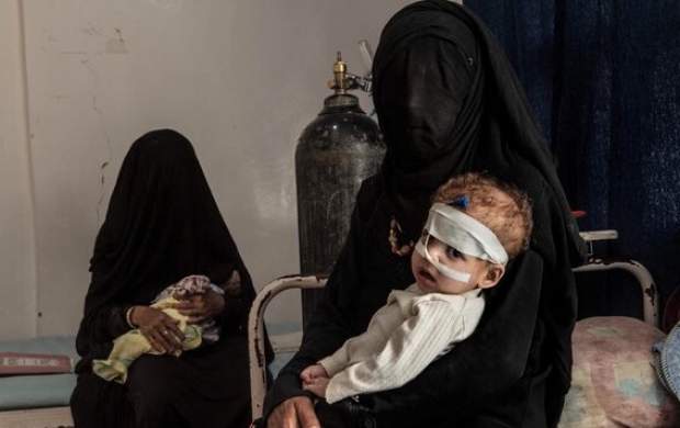 ۲ میلیون کودک یمنی بین مرگ و زندگی به سر میبرند ۲ میلیون کودک یمنی بین مرگ و زندگی به سر میبرند