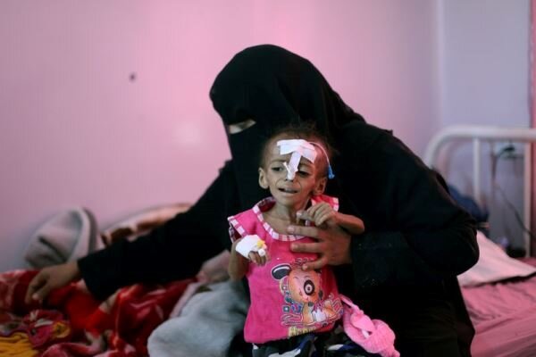 «شمارش معکوس برای وقوع یک فاجعه» در یمن «شمارش معکوس برای وقوع یک فاجعه» در یمن
