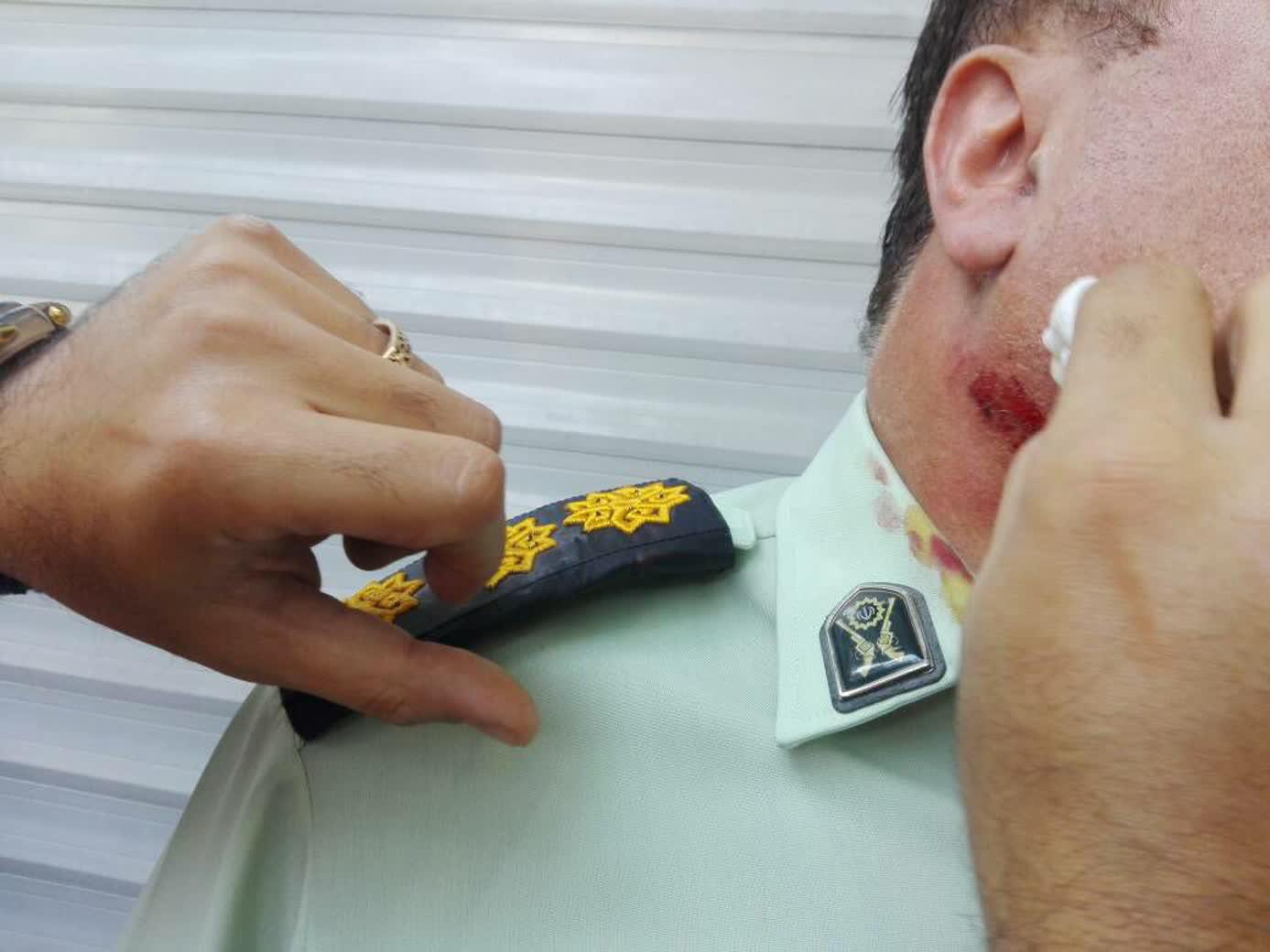 توسط اغتشاشگران:مجروح شدن سرهنگ مافی سرکلانتر هشتم +عکس توسط اغتشاشگران:مجروح شدن سرهنگ مافی سرکلانتر هشتم +عکس